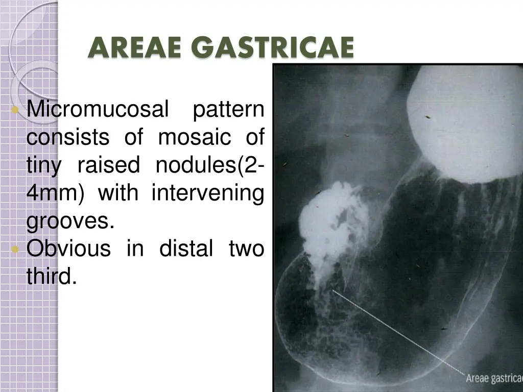 areae gastricae