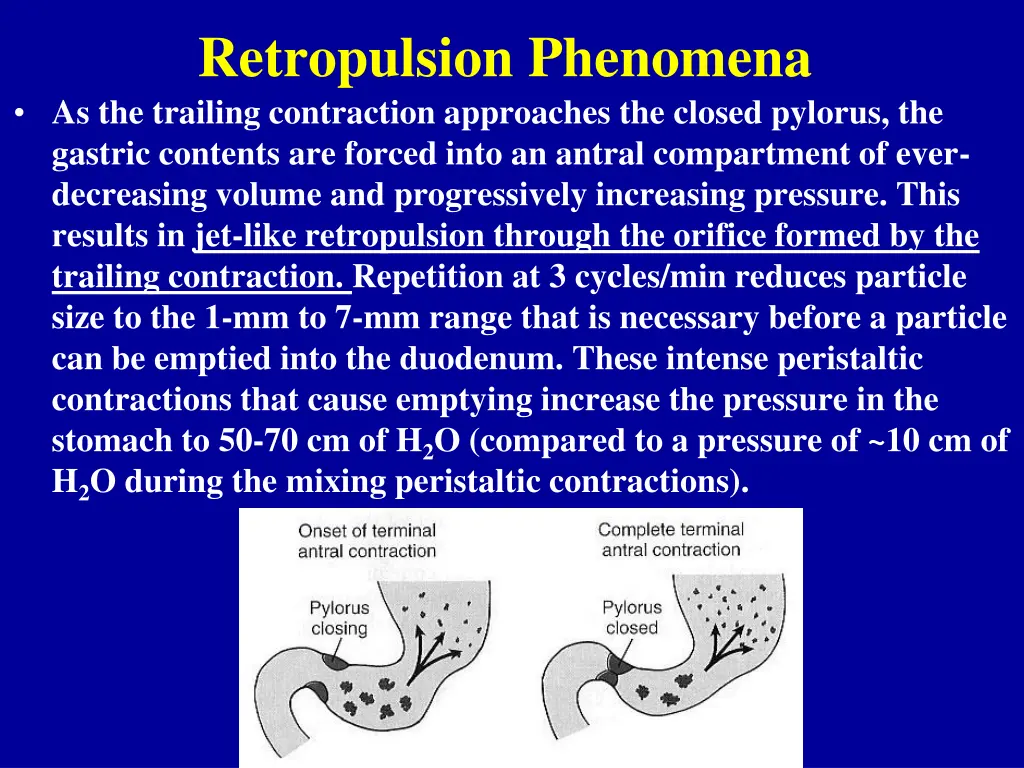 retropulsion phenomena as the trailing