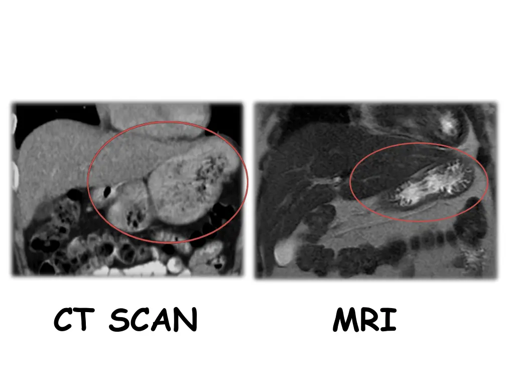 ct scan 1