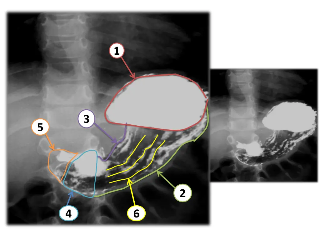 slide23