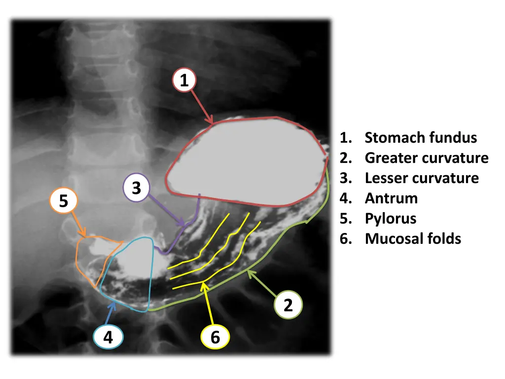 slide24