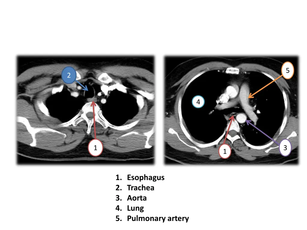 slide7