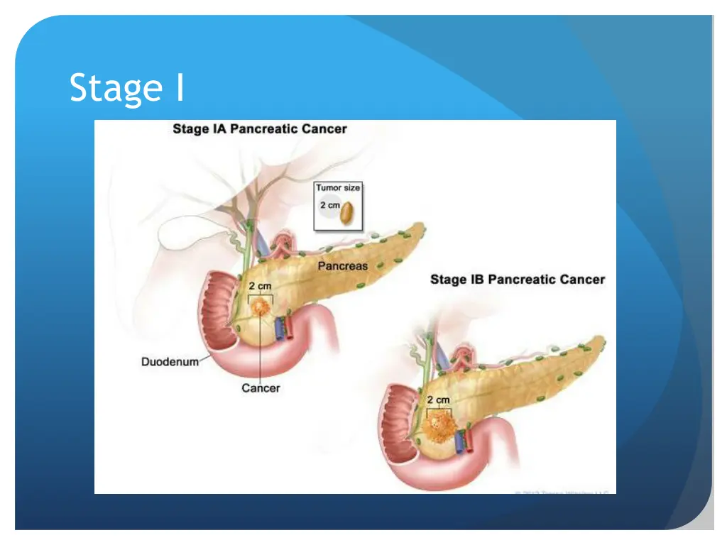 stage i