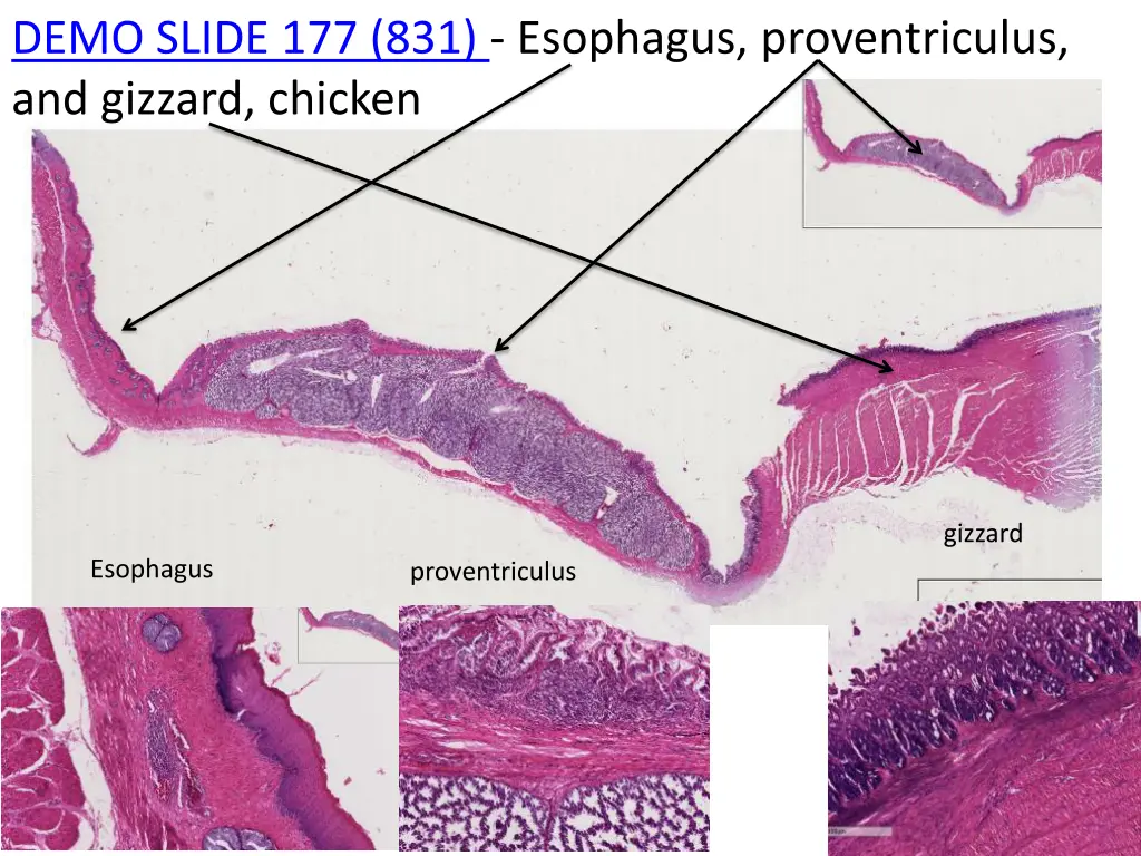 demo slide 177 831 esophagus proventriculus