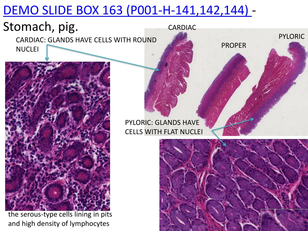 demo slide box 163 p001 h 141 142 144 stomach