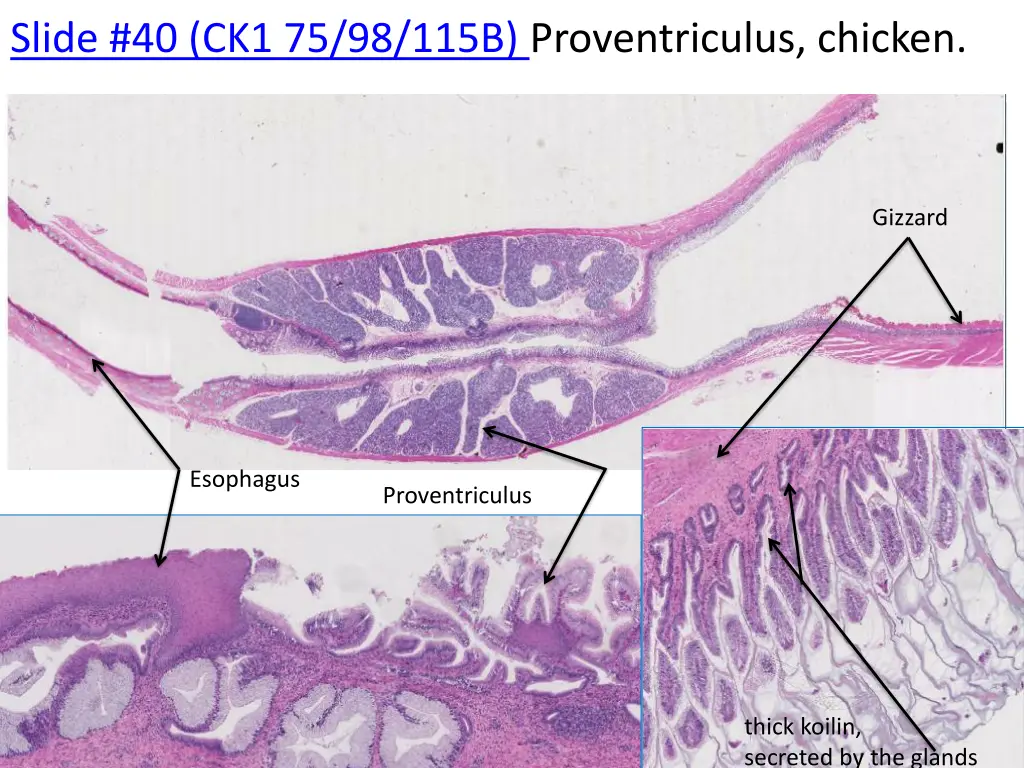 slide 40 ck1 75 98 115b proventriculus chicken