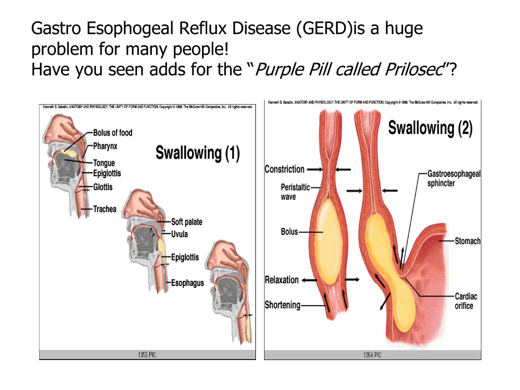 gastro esophogeal reflux disease gerd is a huge