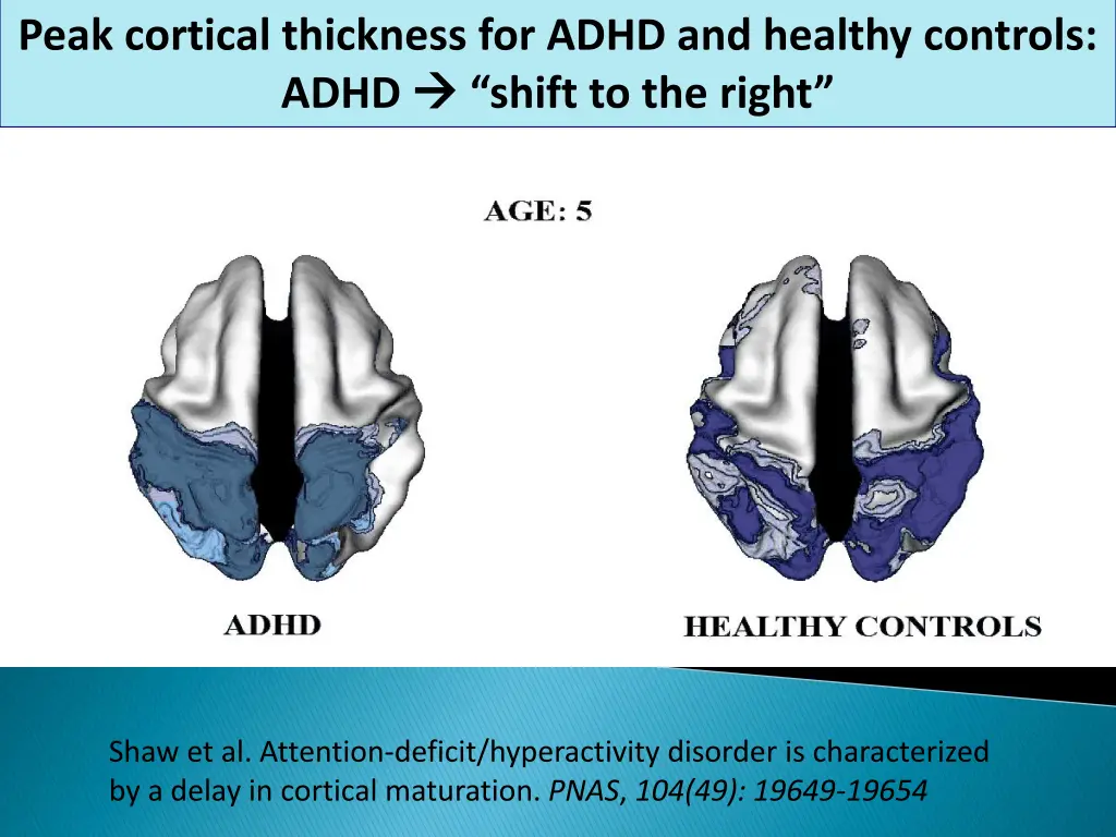 peak cortical thickness for adhd and healthy