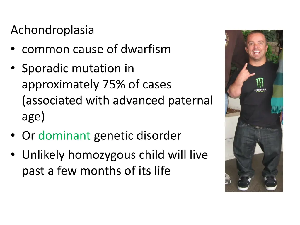 achondroplasia common cause of dwarfism sporadic