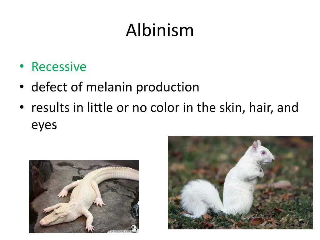 albinism