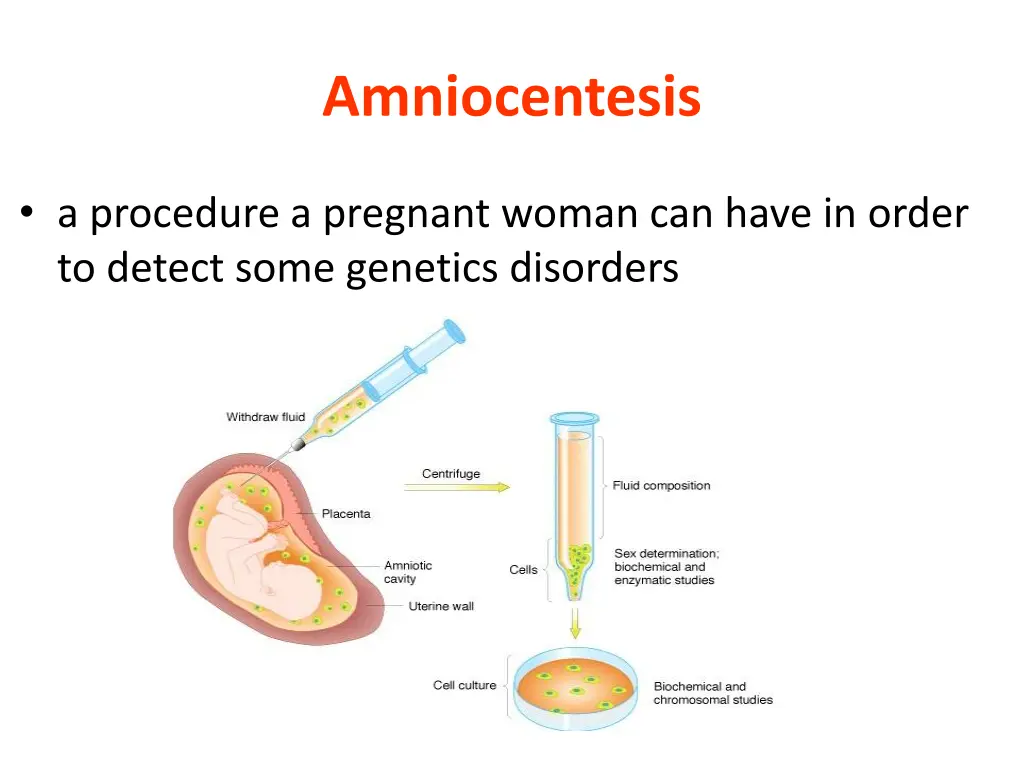 amniocentesis