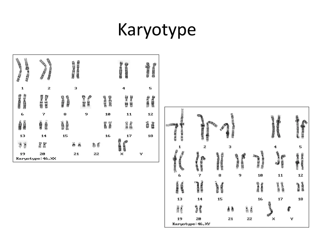 karyotype