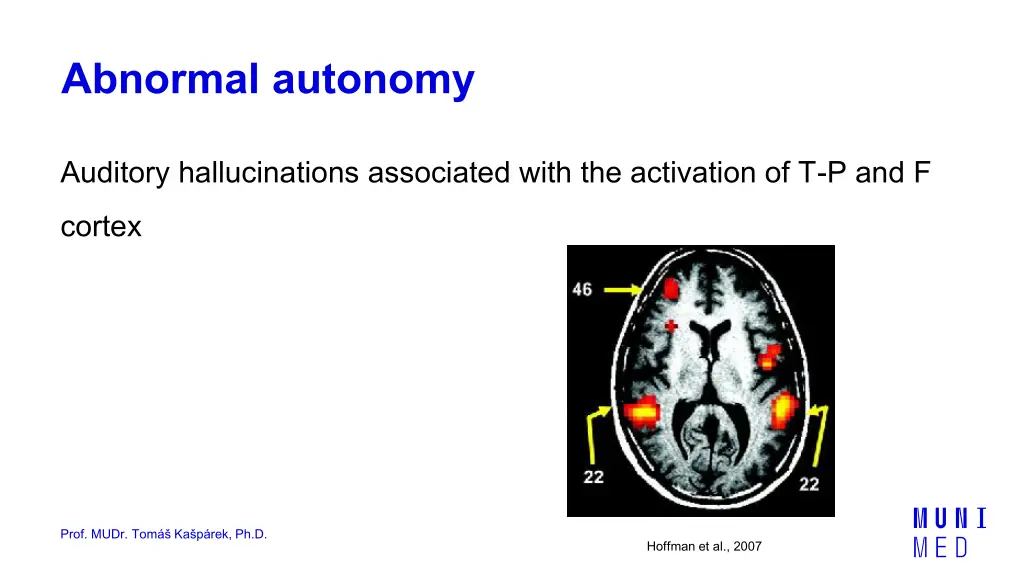 abnormal autonomy