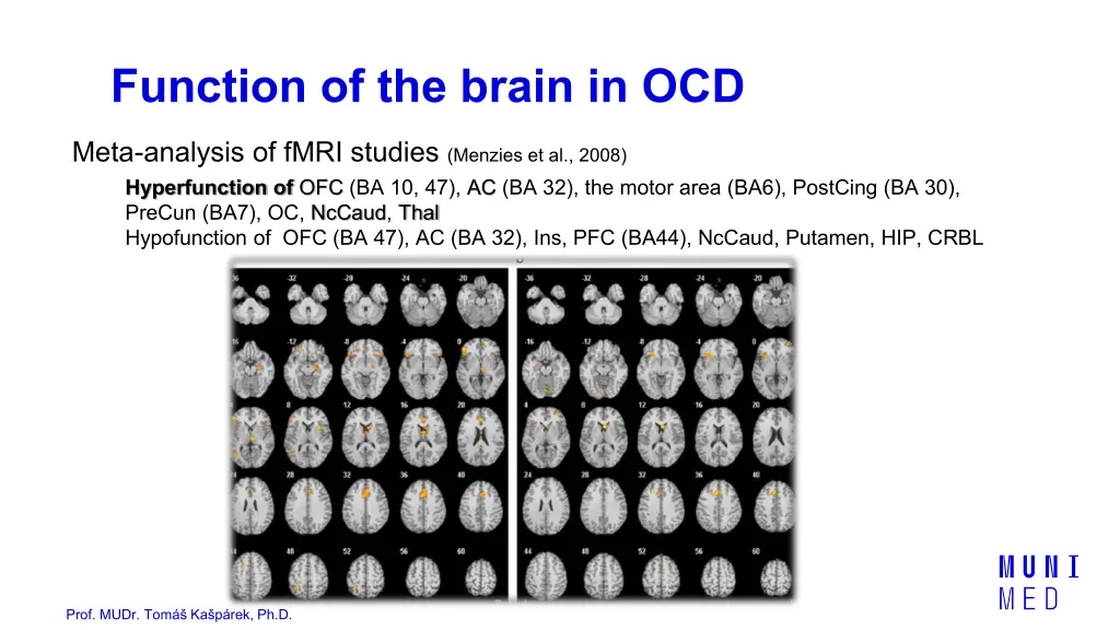 function of the brain in ocd