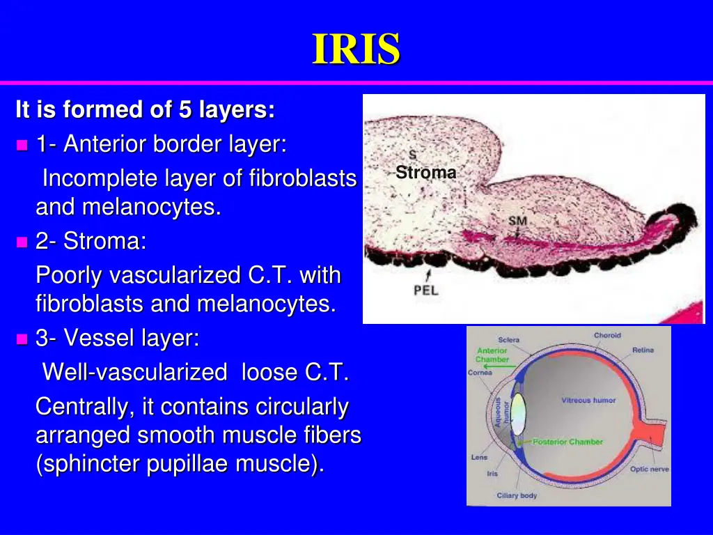 slide13