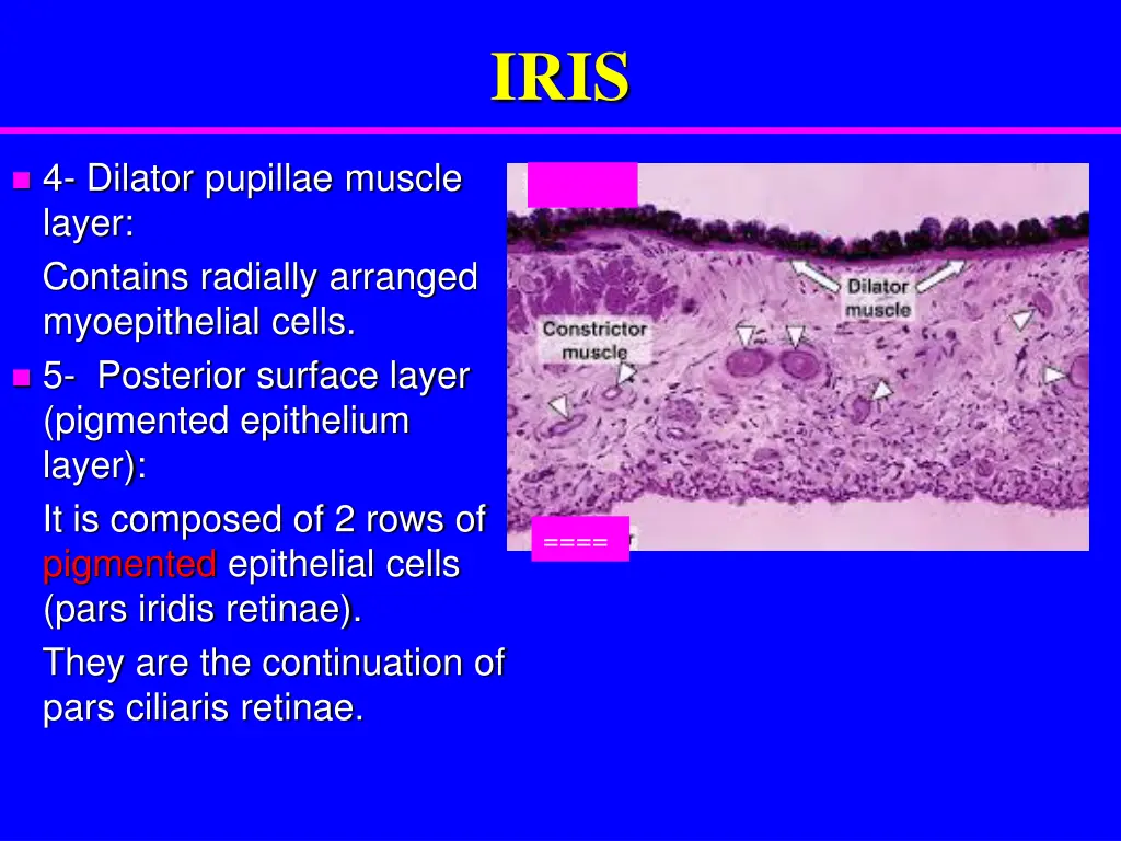 slide14