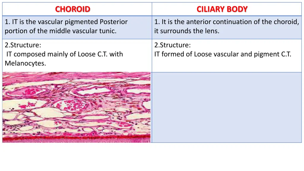 choroid