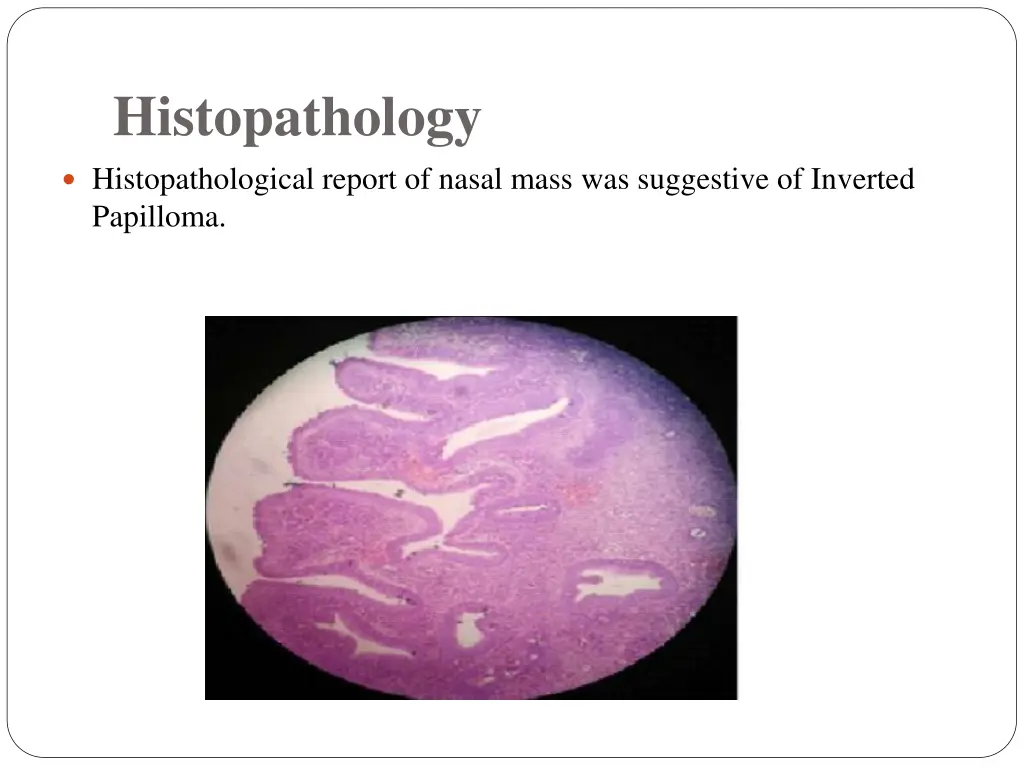 histopathology histopathological report of nasal