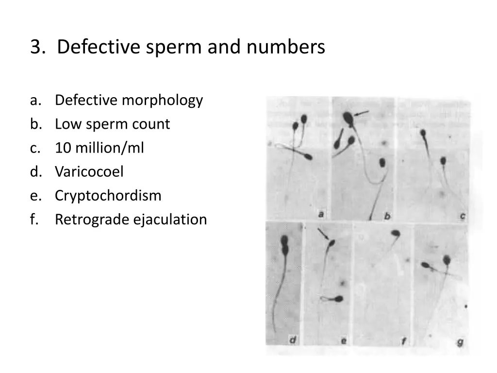 3 defective sperm and numbers