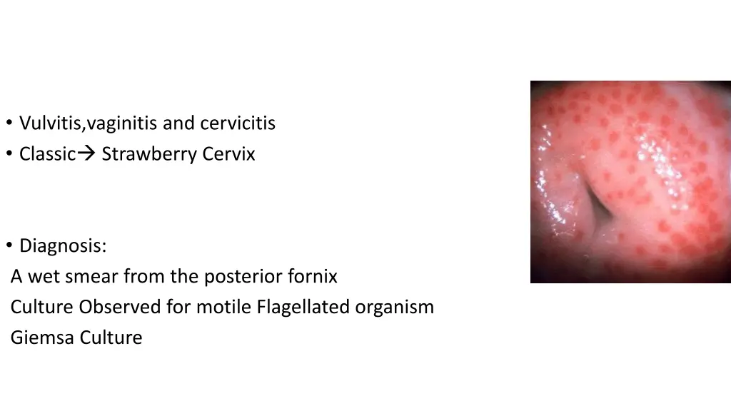 vulvitis vaginitis and cervicitis classic