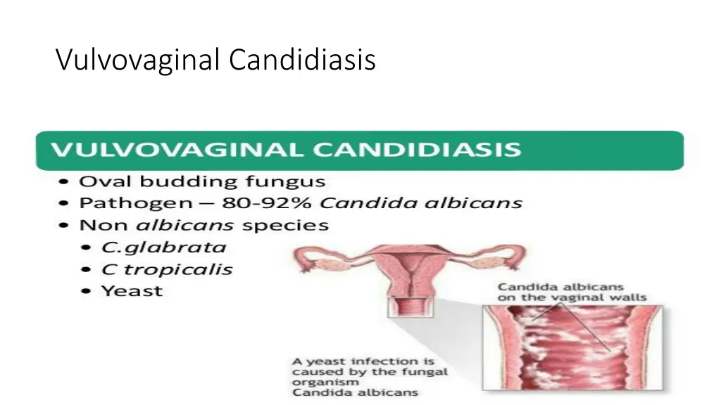 vulvovaginal candidiasis