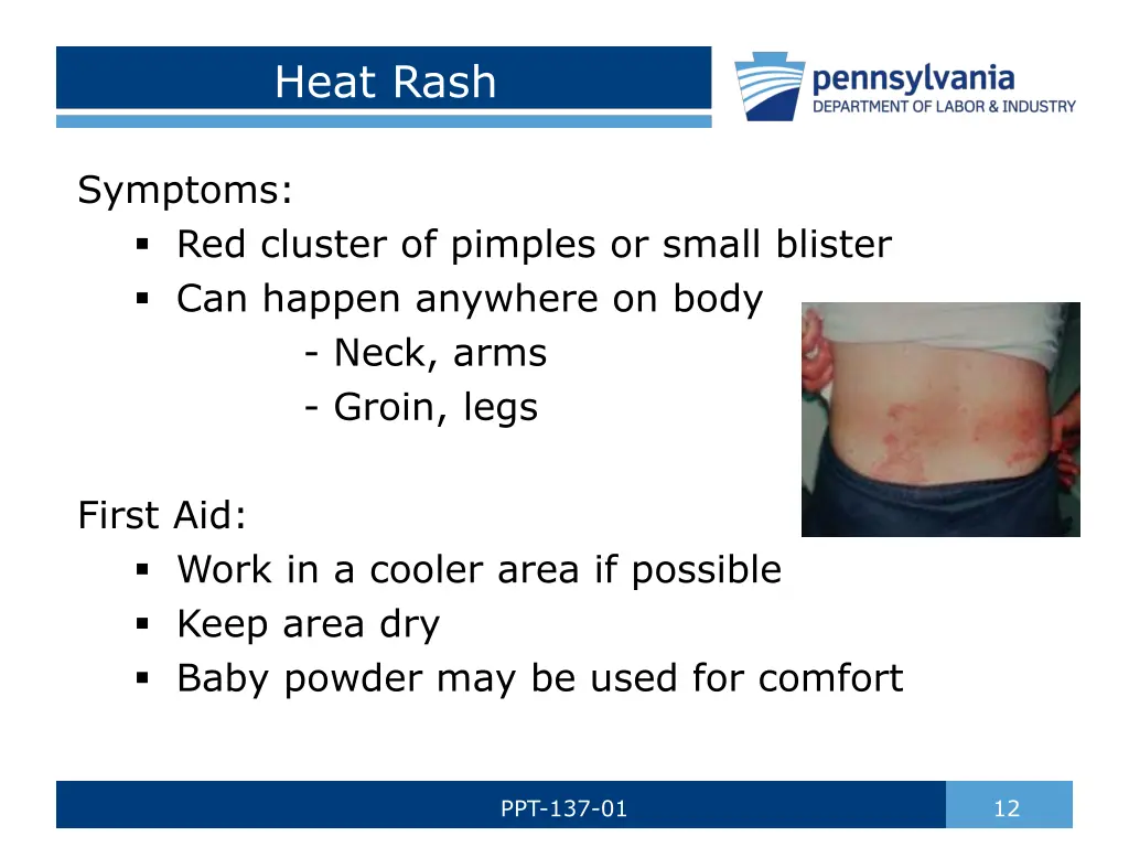 heat rash