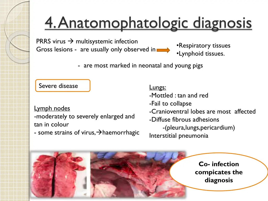 4 anatomophatologic diagnosis