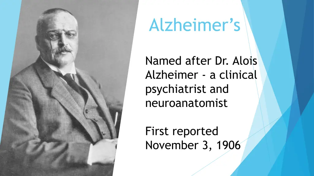 alzheimer s