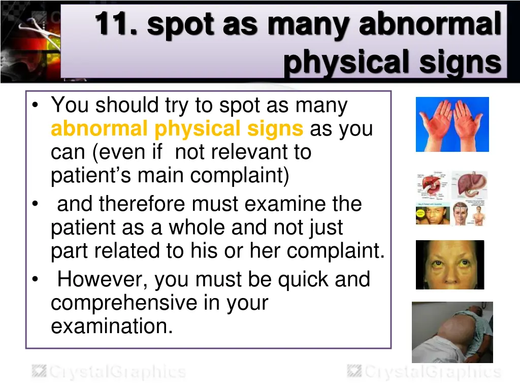 11 spot as many abnormal physical signs