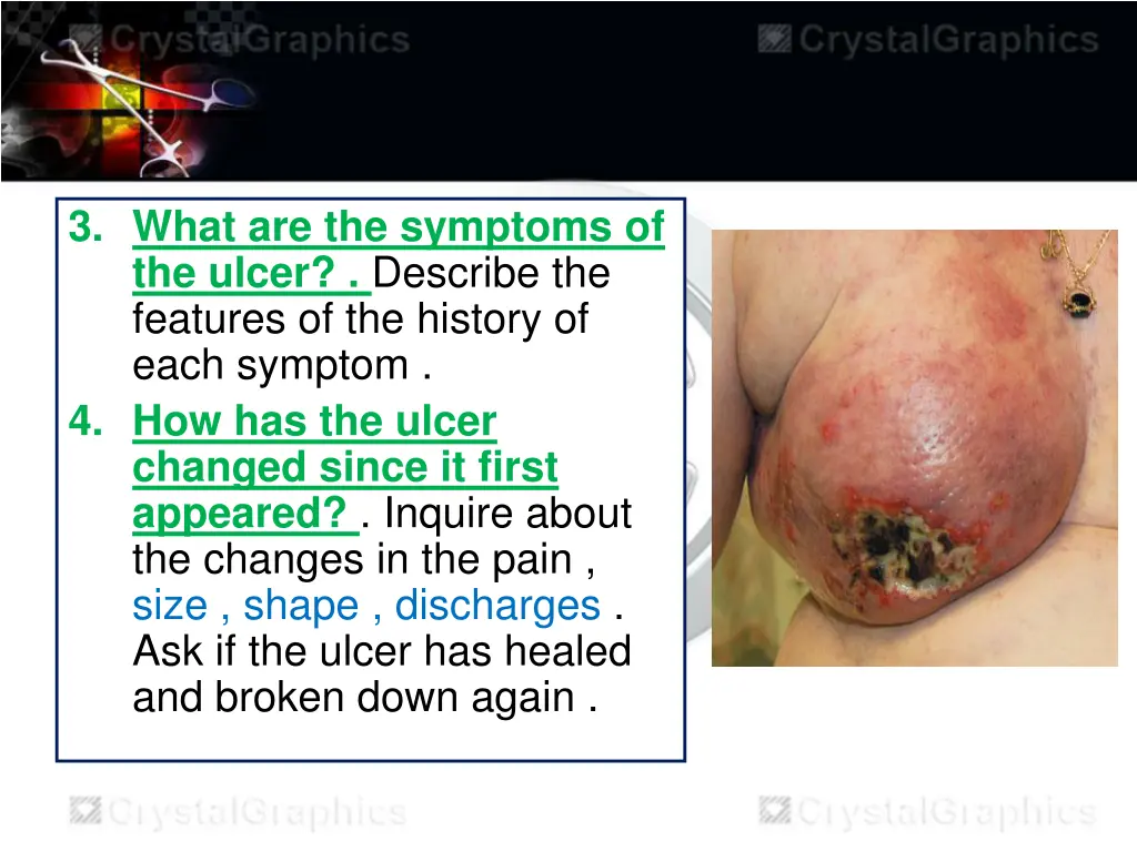 3 what are the symptoms of the ulcer describe