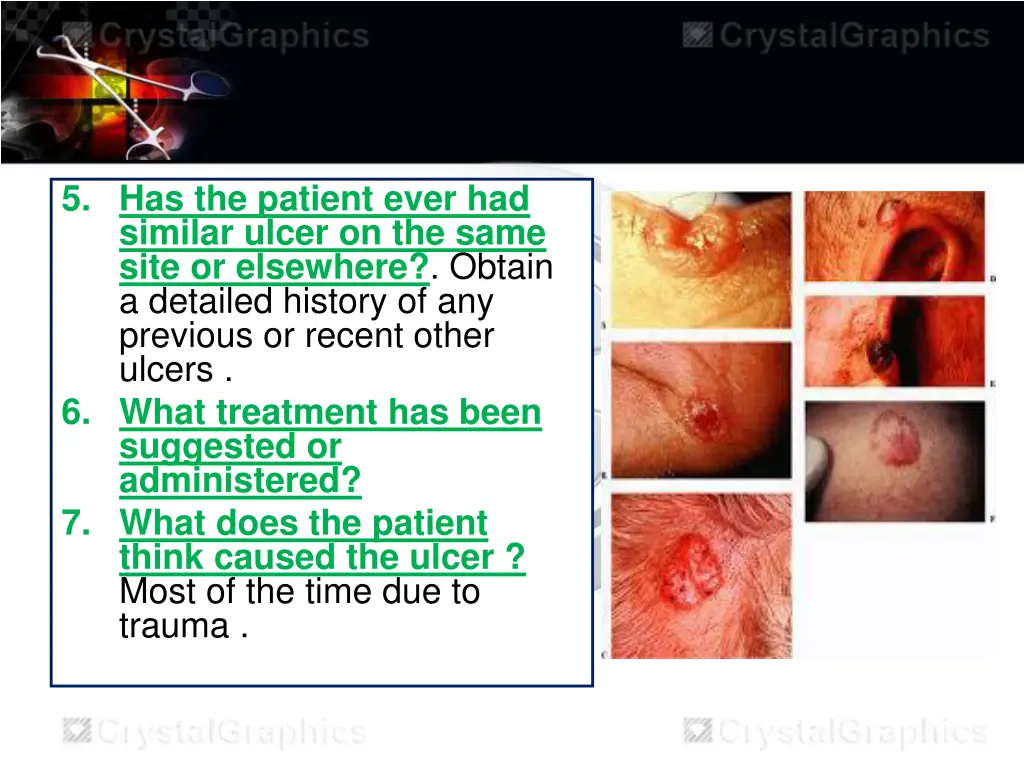 5 has the patient ever had similar ulcer