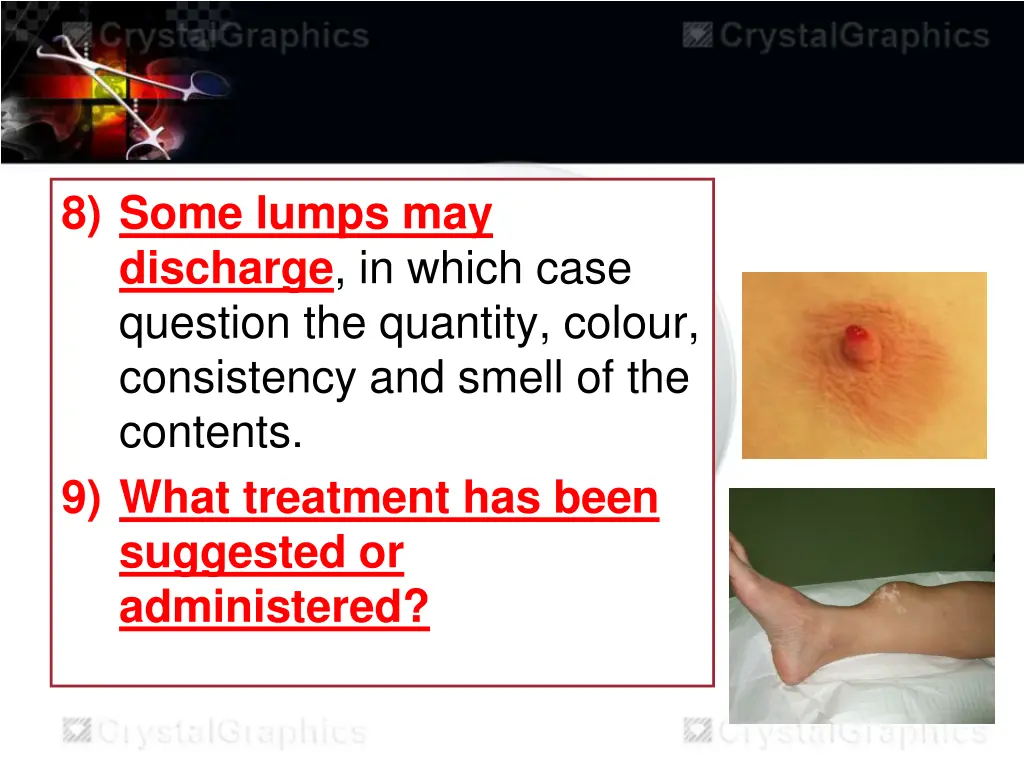 8 some lumps may discharge in which case question