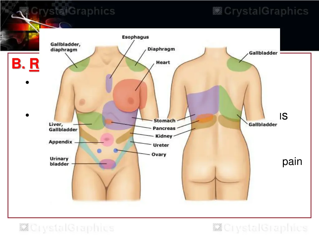 b referred pain is a pain which is felt