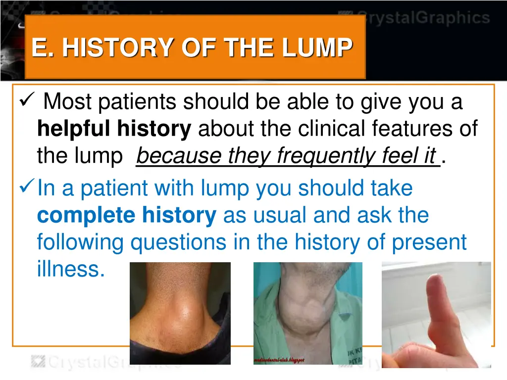 e history of the lump