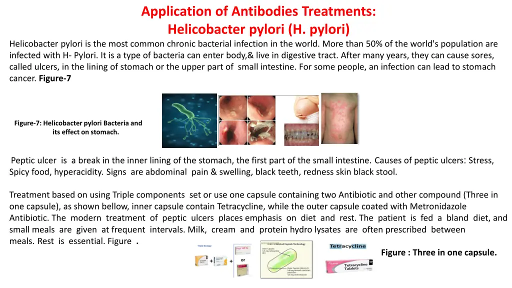 application of antibodies treatments helicobacter