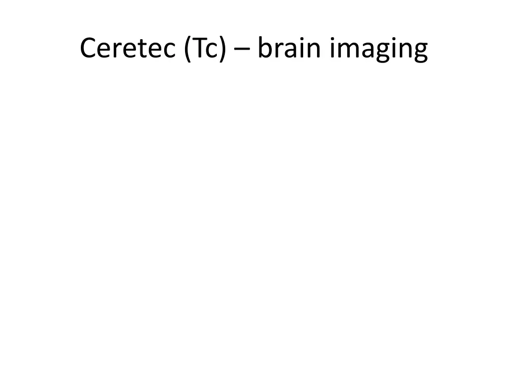 ceretec tc brain imaging