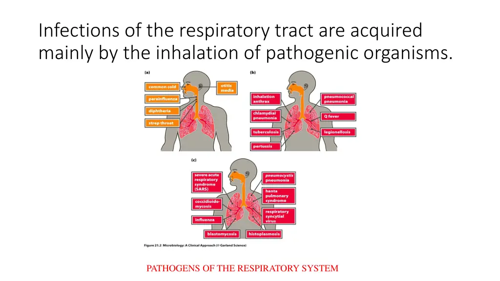 infections of the respiratory tract are acquired