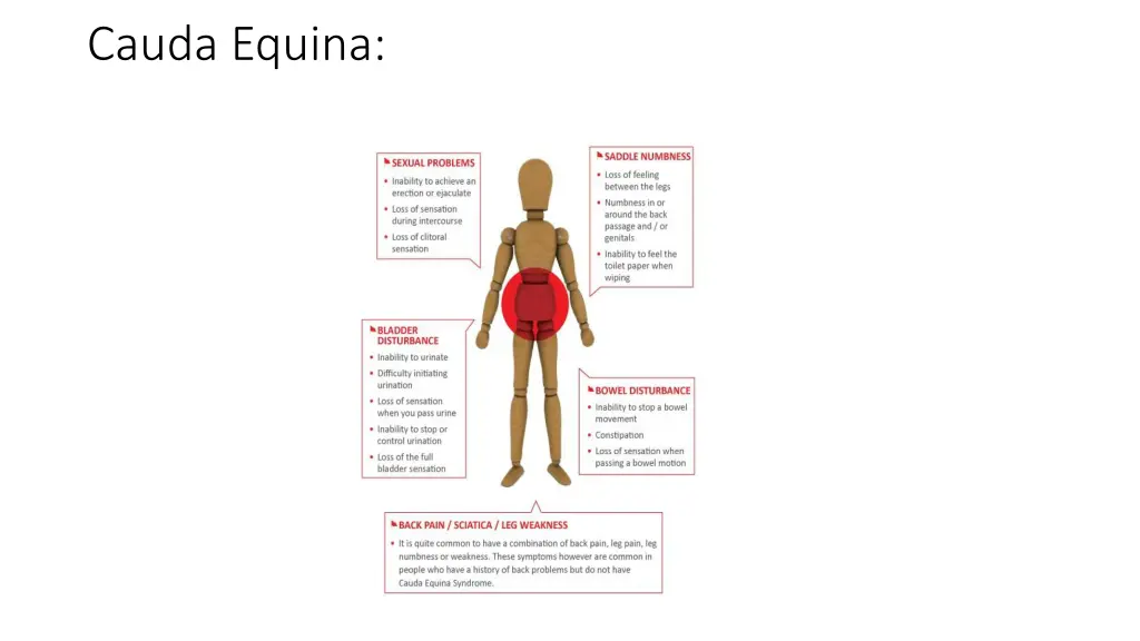 cauda equina