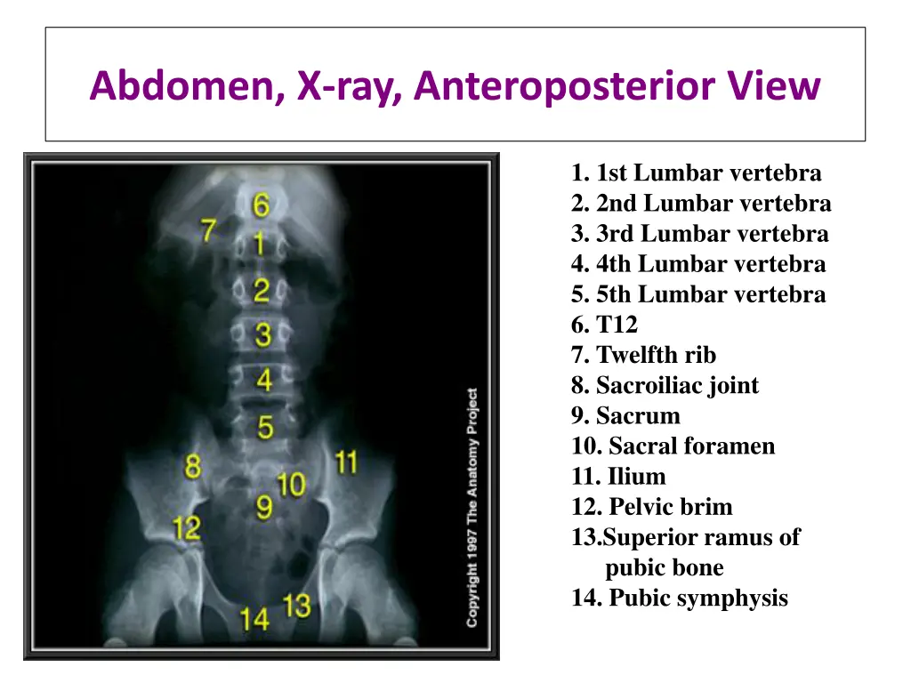 abdomen x ray anteroposterior view