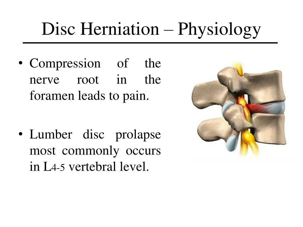 disc herniation physiology 1