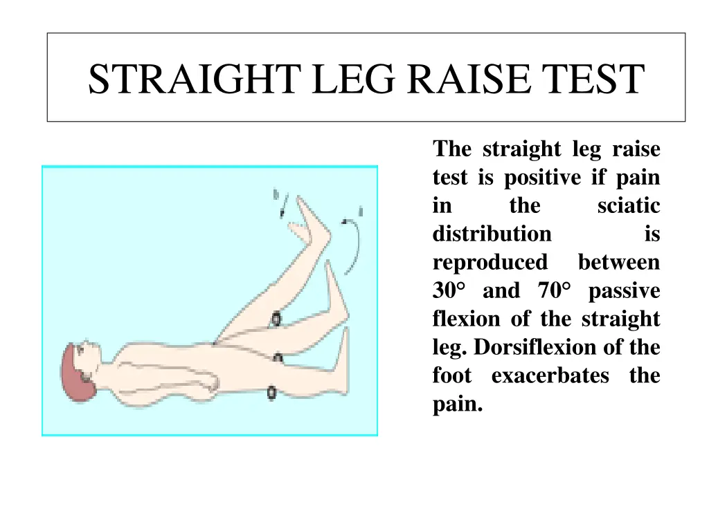 straight leg raise test straight leg raise test