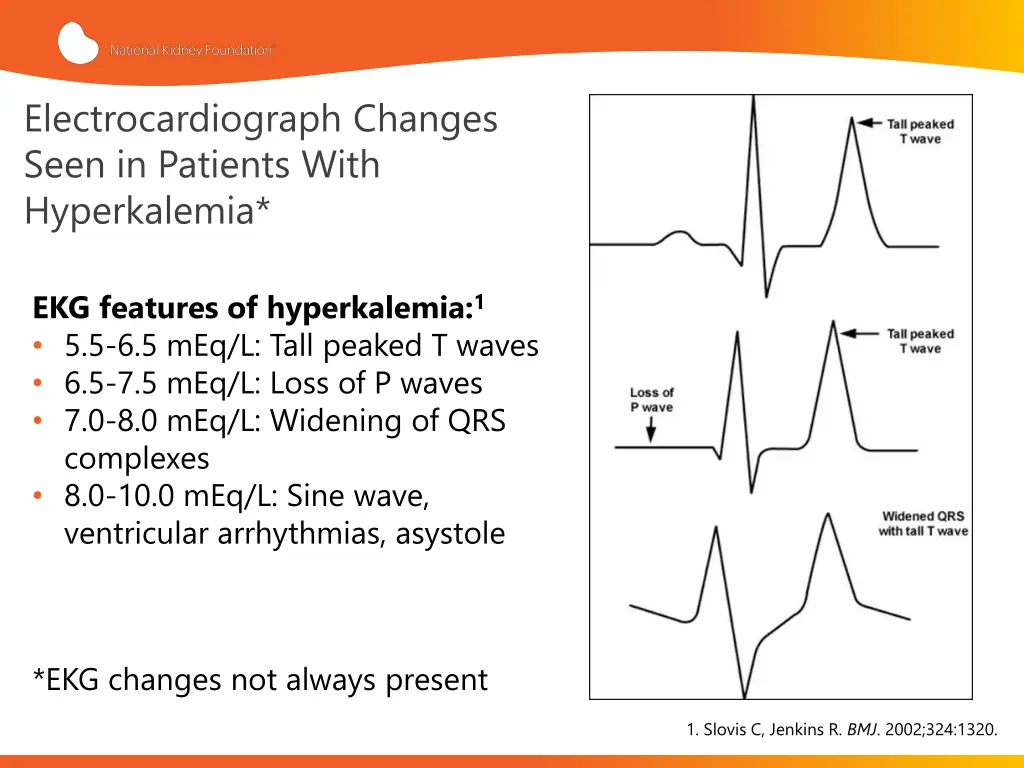 electrocardiograph changes seen in patients with