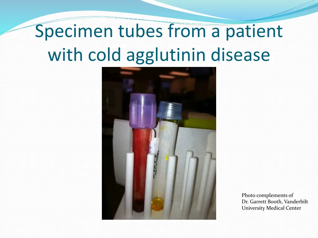 specimen tubes from a patient with cold