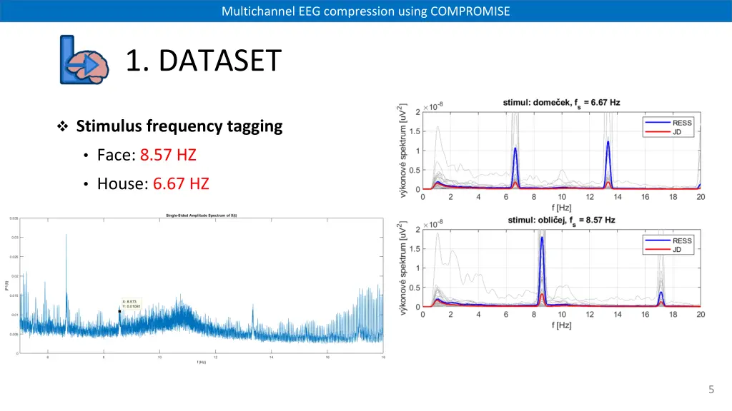 multichannel eeg compression using compromise 4