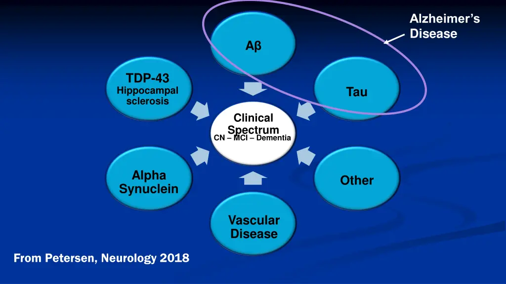 alzheimer s disease