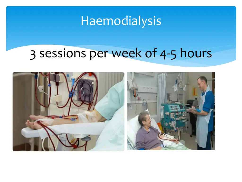 haemodialysis