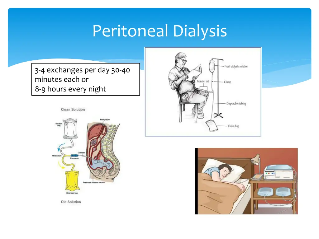 peritoneal dialysis