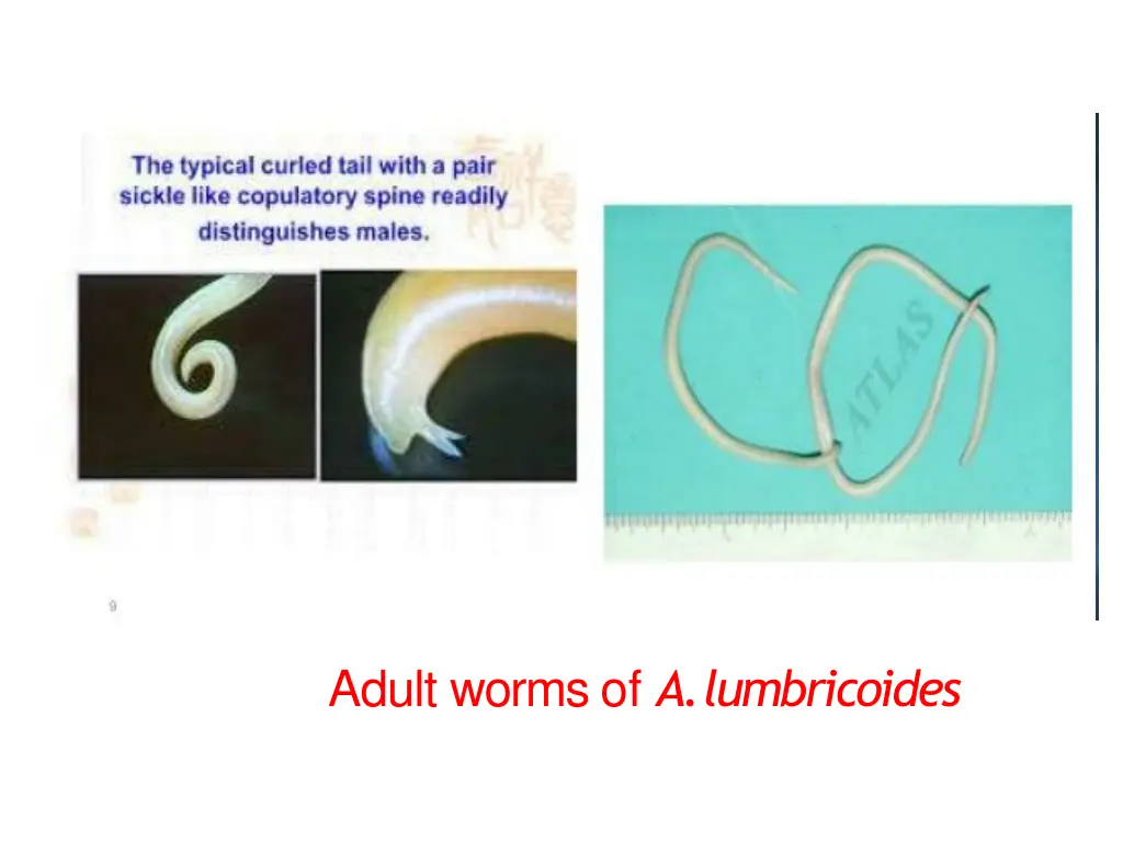 adult worms of a lumbricoides