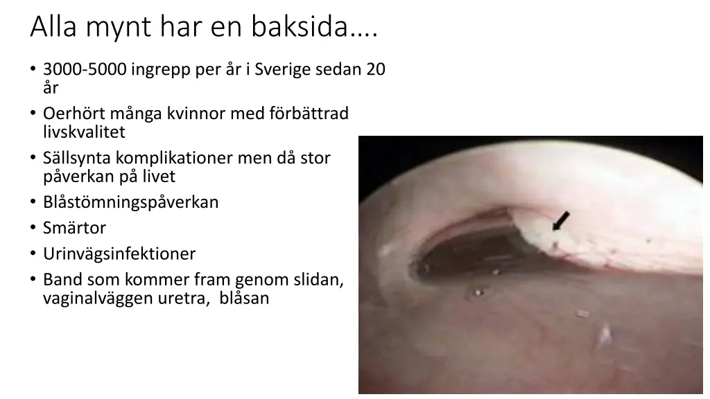 alla mynt har en baksida