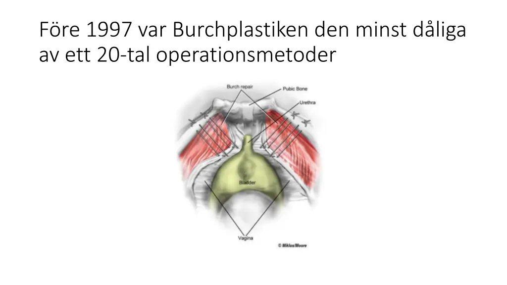 f re 1997 var burchplastiken den minst d liga